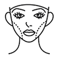 buccal fat removal surgery
