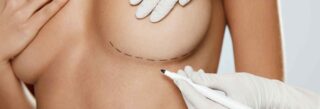 Breast Implants That Look Natural-Dr Cotrufo, Rated Excellent